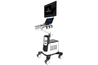 УЗИ аппарат Chison QBIT 11